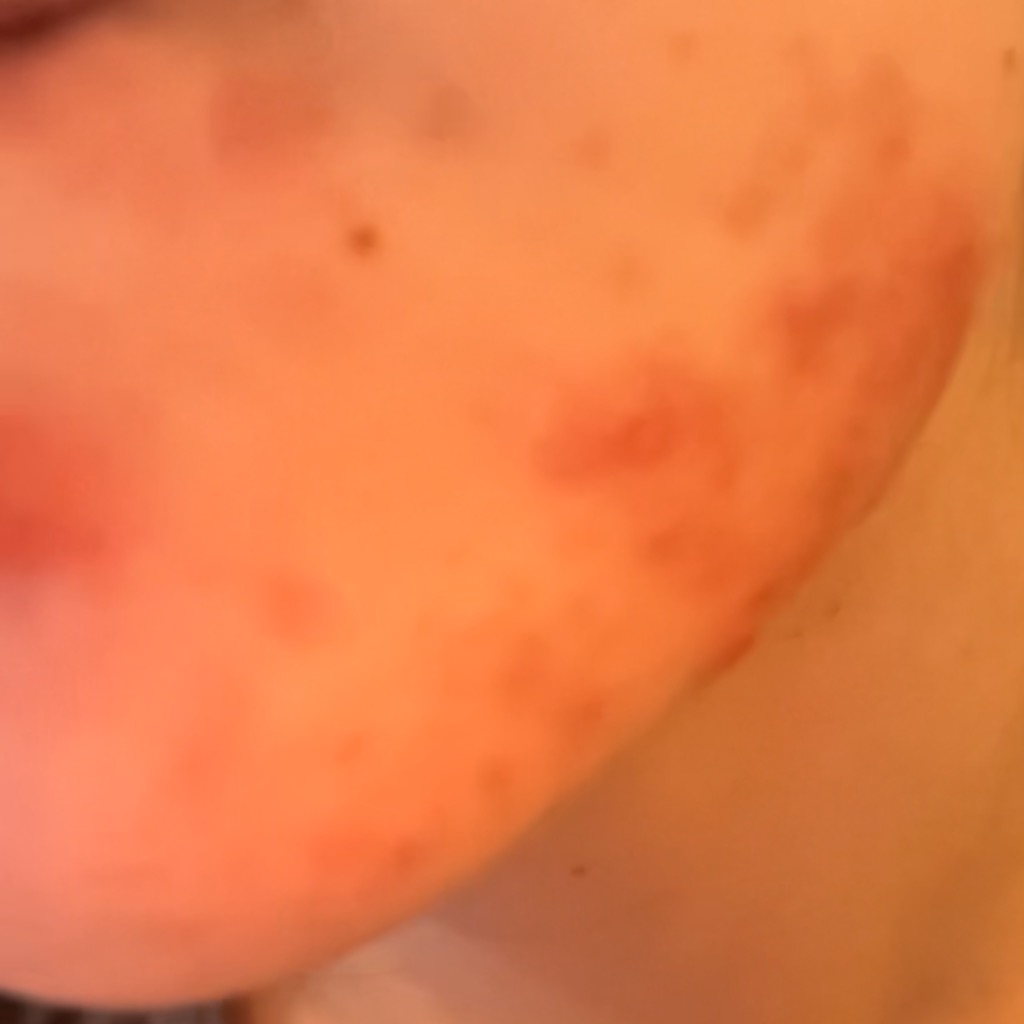 Avant utilisation de Crème sans Huile SET Secret teint Éclatant Pinup-Secret