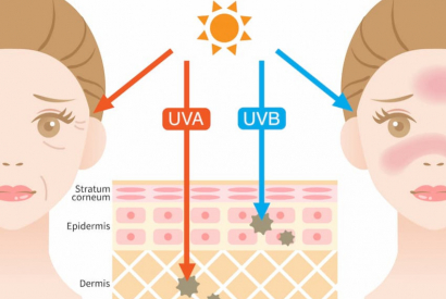 Protection de la peau contre le soleil : ce que vous devez savoir