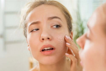 J’ai la peau sèche : comment y remédier efficacement ?